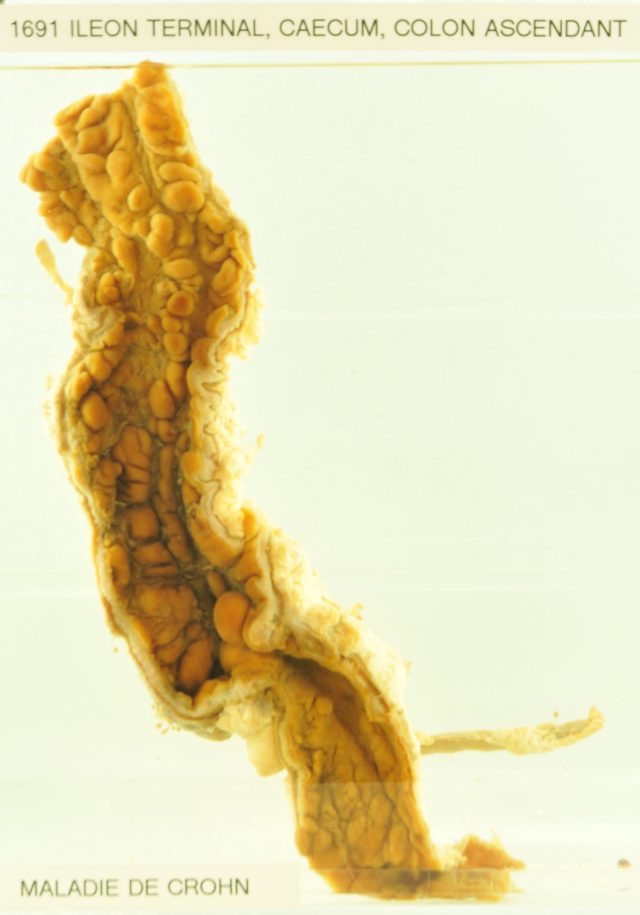 Oral inflammation may impair female fertility, new Israeli Oral inflammation may impair female fertility, new Israeli