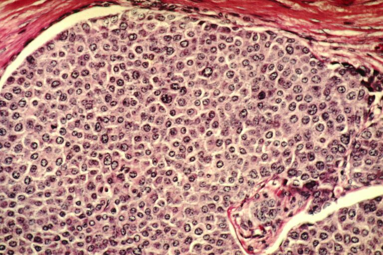Notable March 2024 Deaths Highlight Cancer Toll